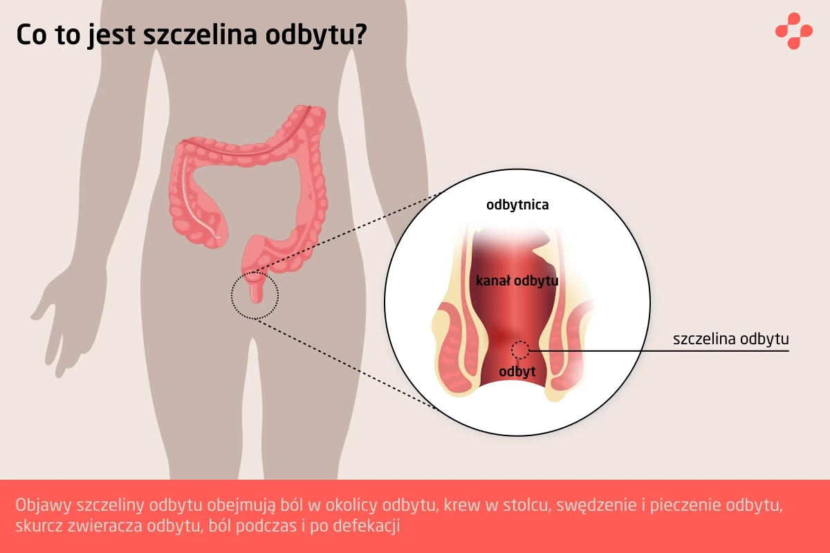 Czym jest szczelina odbytu?