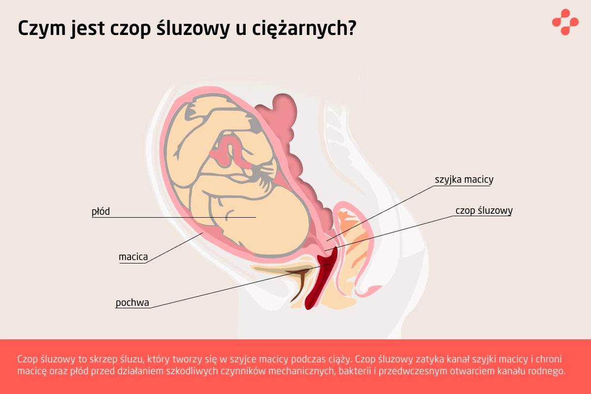 Czym jest czop śluzowy?