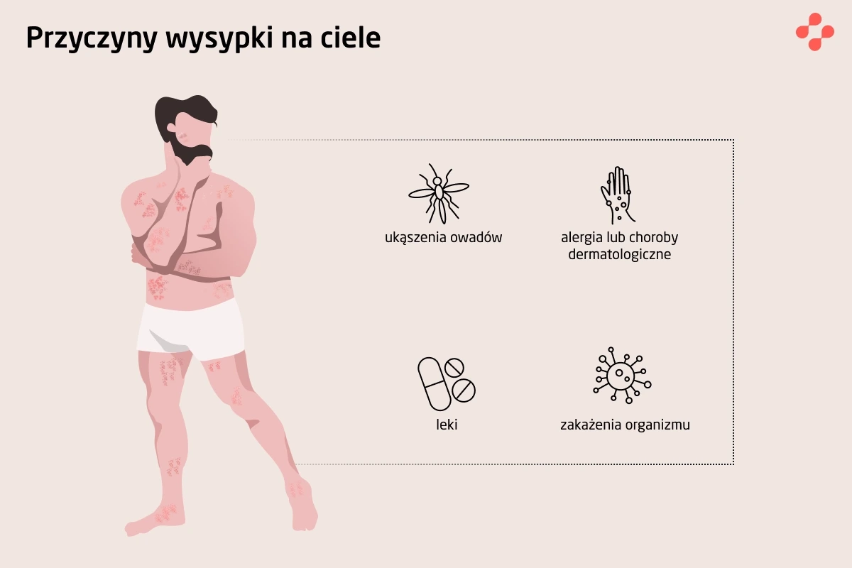 Przyczyny pojawienia się wysypki