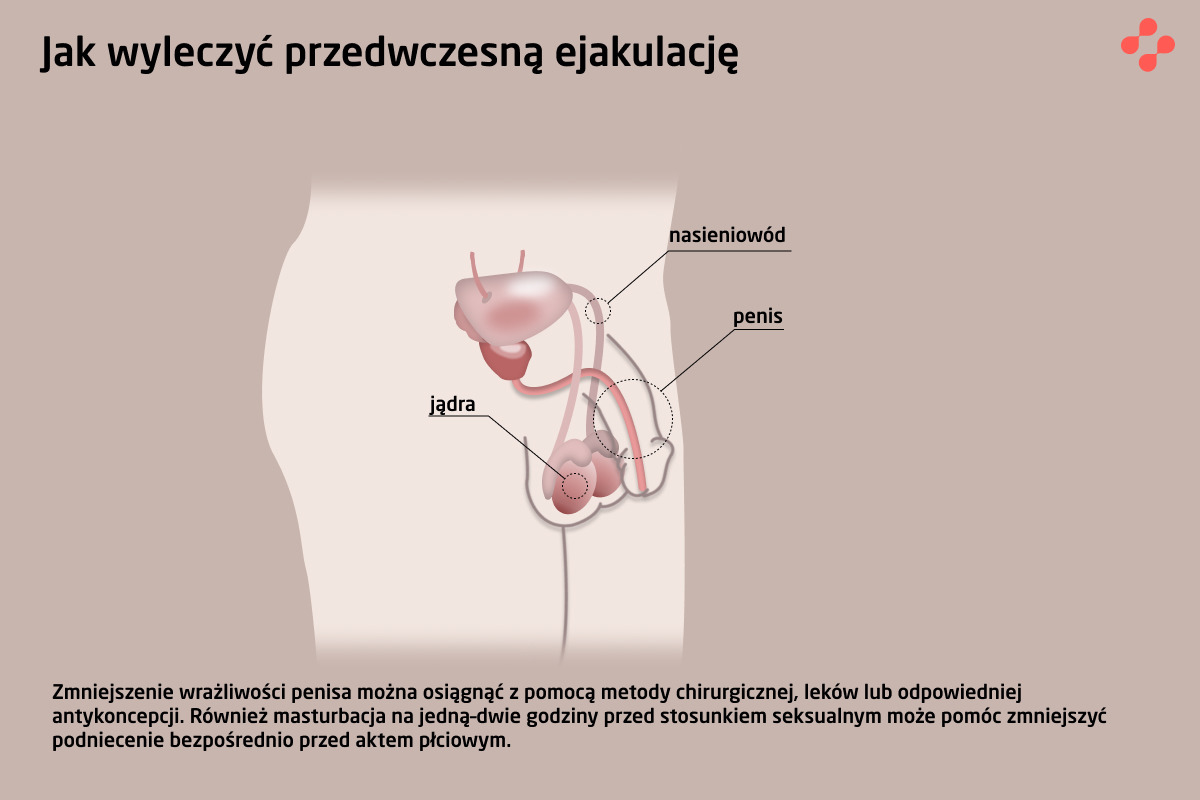 Jak wyleczyć przedwczesną ejakulację