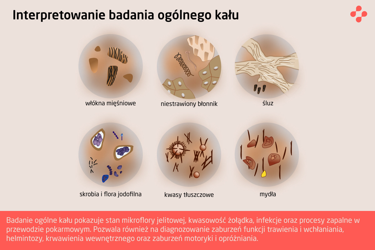 Interpretowanie badania ogólnego kału