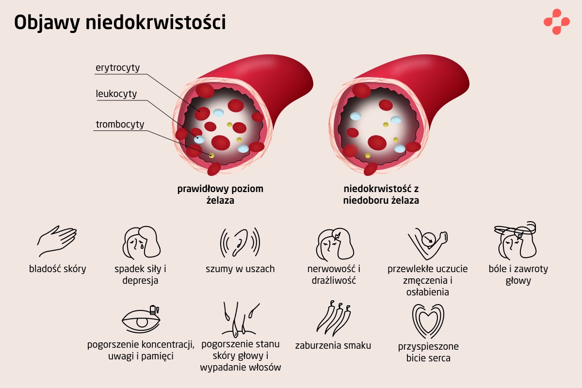 Objawy niedokrwistości