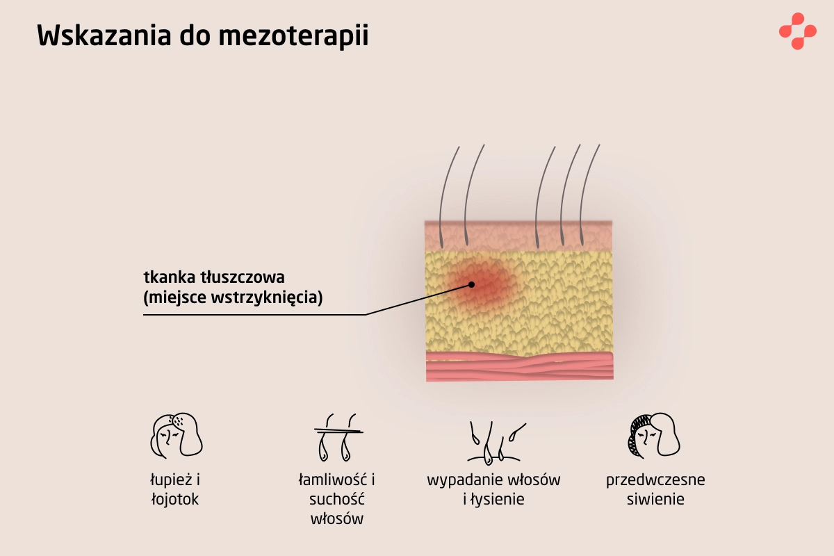 Wskazania do mezoterapii